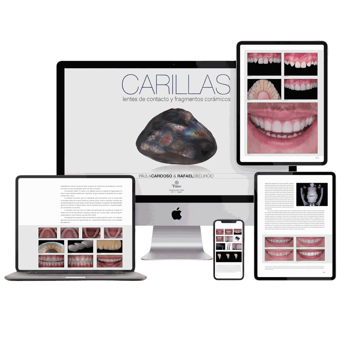 eBook Carillas y Lentes de Alta Performance