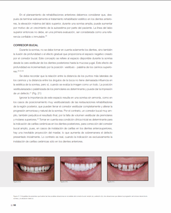 Corredor bucal y análisis de sonrisa