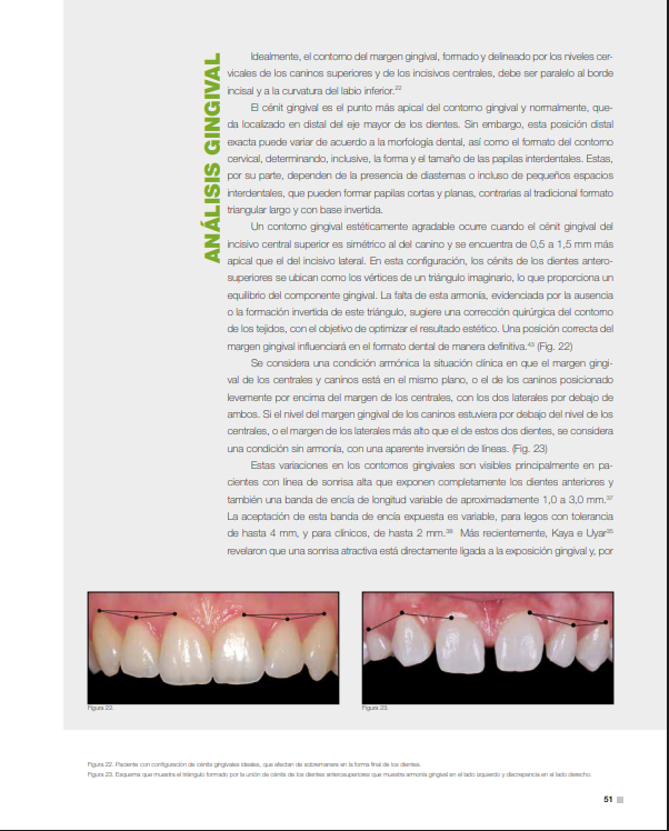 Análisis gingival y contorno