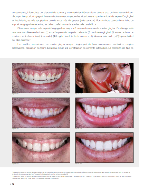 Casos clínicos con toxina botulínica