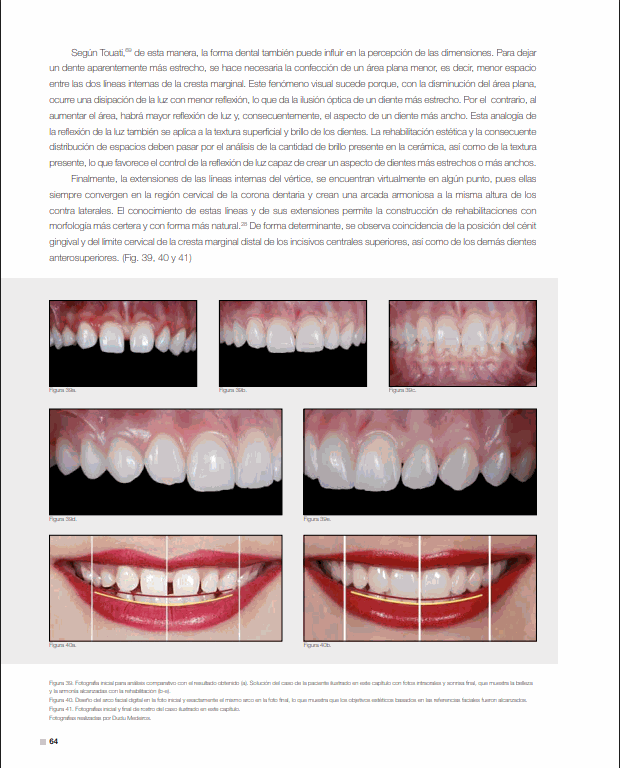 Rehabilitación estética final