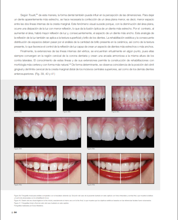 Rehabilitación estética final